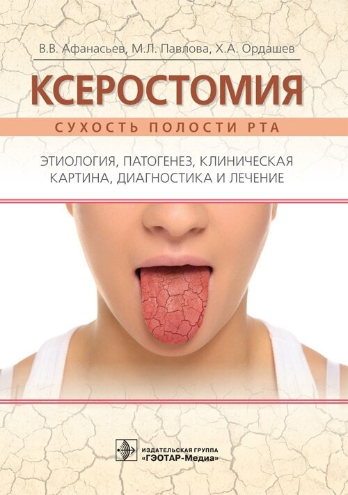 Ксеростомия. Сухость полости рта. Этиология, патогенез, клиническая картина, диагностика и лечение