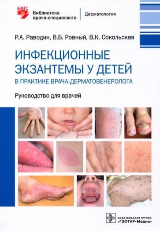 Инфекционные экзантемы у детей в практике врача-дерматовенеролога руководство для врачей - фото №1