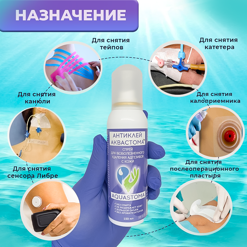 Очиститель для кожи Аквастома Антиклей, аэрозоль для удаления адгезивов с кожи, снятия калоприемников, снятия сенсора Либре, 150 мл — фото 1