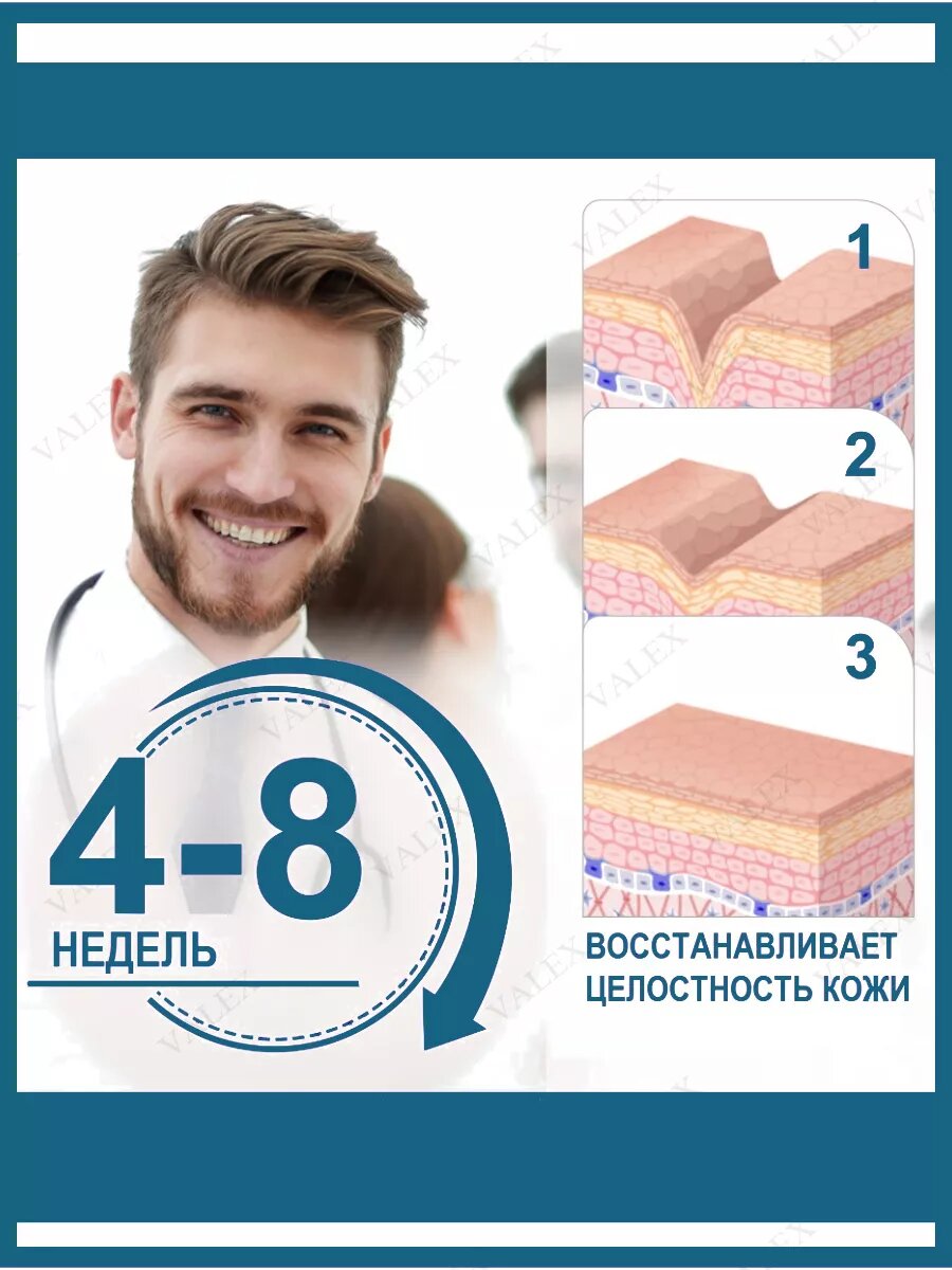 Картинки Пластырь PEPHUCA, от шрамов и рубцов, силиконовый, бежевый, 4x300 см