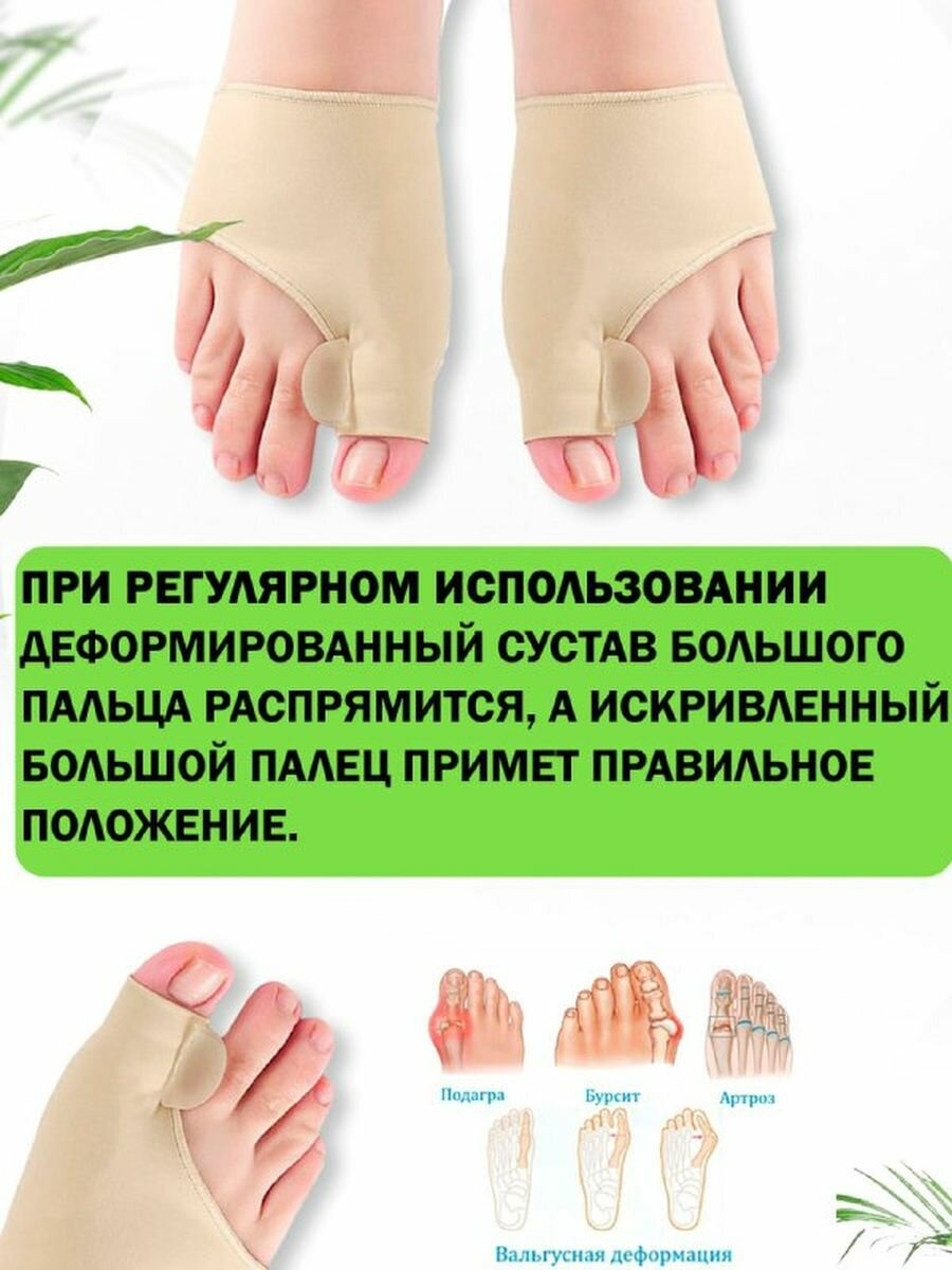 Изображение Комплект от косточек на ногах QuisLife: Вальгусная шина бандаж 1 пара, Шарнирная шина 1 пара