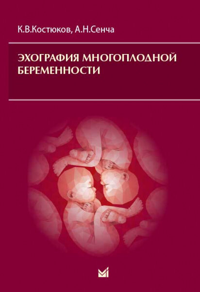 Эхография многоплодной беременности - фото №3