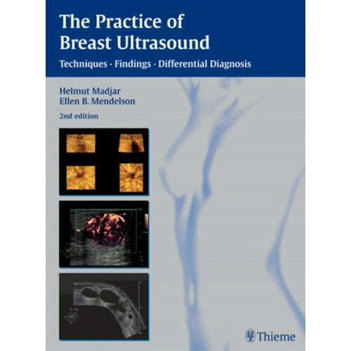 Helmut Madjar "The Practice of Breast Ultrasound: Techniques, Findings, Differential Diagnosis"