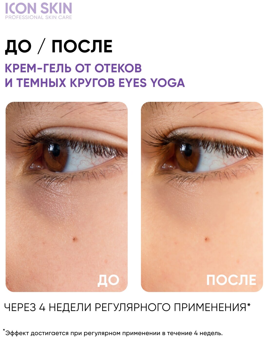 ICON SKIN / Крем-сыворотка для кожи вокруг глаз Eyes Yoga от отёков с гиалуроновой кислотой, 15 мл