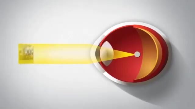 Астигматические линзы ACUVUE OASYS 1-Day with HydraLuxe for Astigmatism (30 линз) Ось 80, Оптическая сила цилиндра -1.75 +0.25 R 8.5, однодневные, прозрачные — фото 1