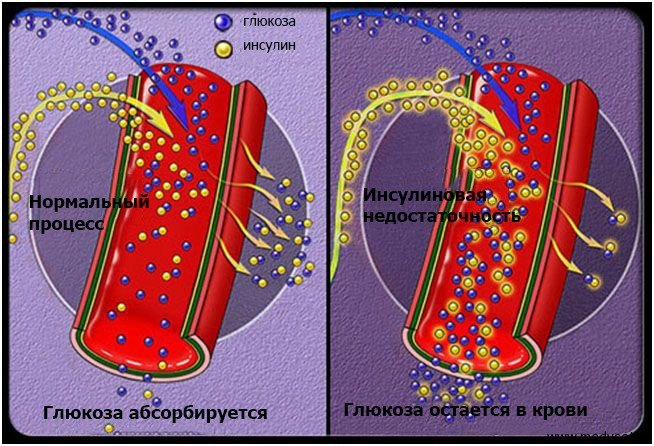 Fobrinol - напиток от диабета  в Амурске. - Лечение Диабета 
Сайт производителя...
 http://sekahspotok.com/cO8T/





Пищевая добавка Fobrinol при диабете помогает снизить уровень сахара в крови и улучшить функционирование поджелудочной железы. Отзывы, инструкция по применению, состав и свойства. Самые крупные клинические испытания « - напиток от сахарного диабета» были проведены в Германии в конце года. Оба продукта содержат полисахариды, помогающие подсластить еду и напитки без использования «быстрых» углеводов. - напиток от диабета купить в Королёве Фобринол от диабета: цена, отзывы, где купить Fobrinol - напиток от диабета юрия (Фобринол):от диабета, цена в аптеке, отзывы врачей Живи вкусно, живи легко - Эти факторы превосходят любые 
