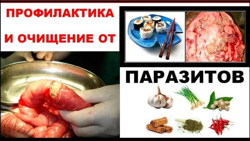 паразиты в организме фото