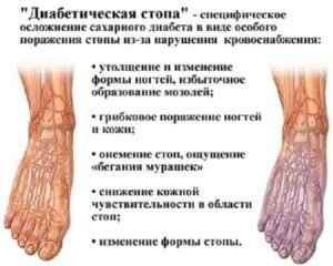 диабетическая стопа фото