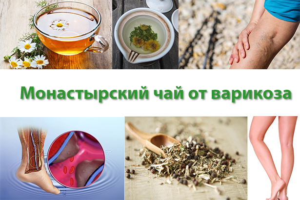 народные средства от варикоза фото