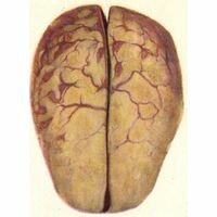 21 Cards In The Collection "Капли Иммунал Плюс" Of The User Ashley.