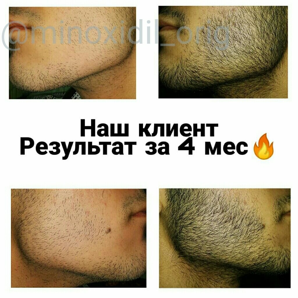 regain для бороды фото