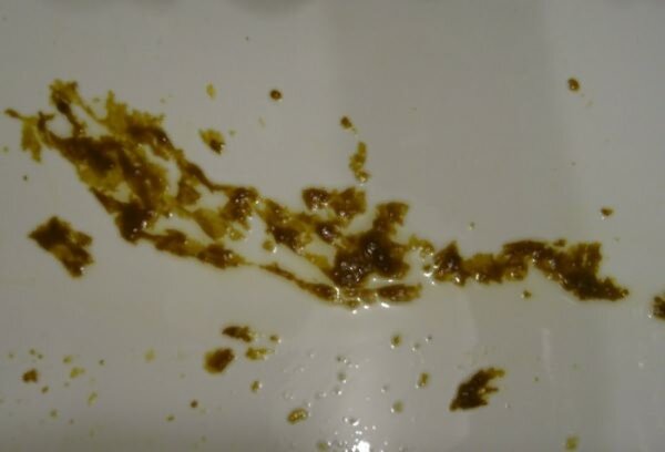 «Глисты ФОТО http://charloteb.cf/E160E/ Мало кого привлекает слово ...