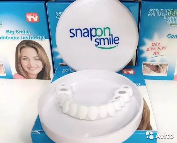 Snap on smile vélemények