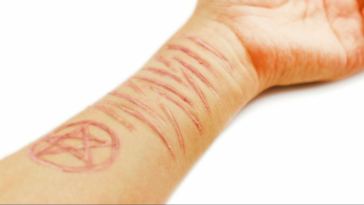 How to heal a cut on face without scarring