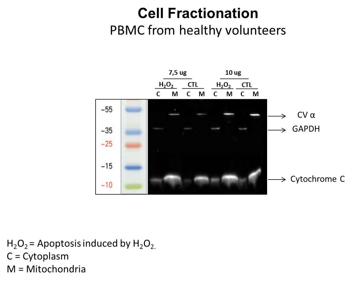 tp pcr electrophoresis фото