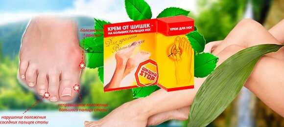 мазь от шишек на ногах фото