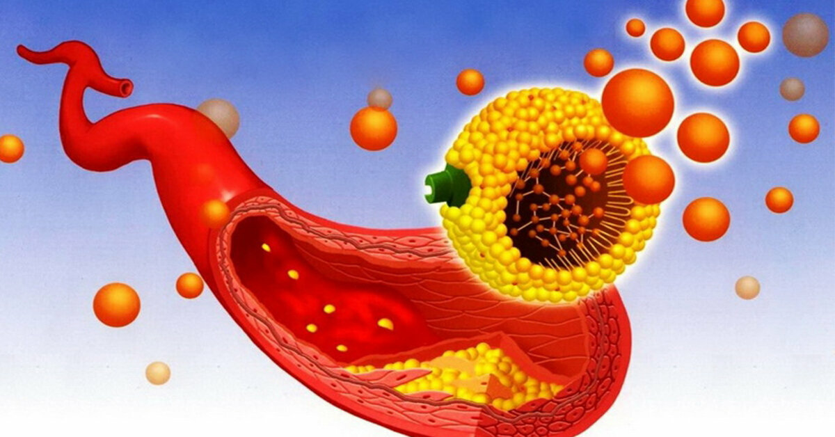 Холестерин картинки для презентации