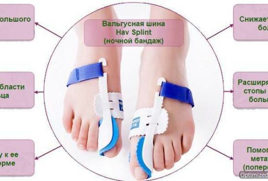 вальгусная шина hav splint фото