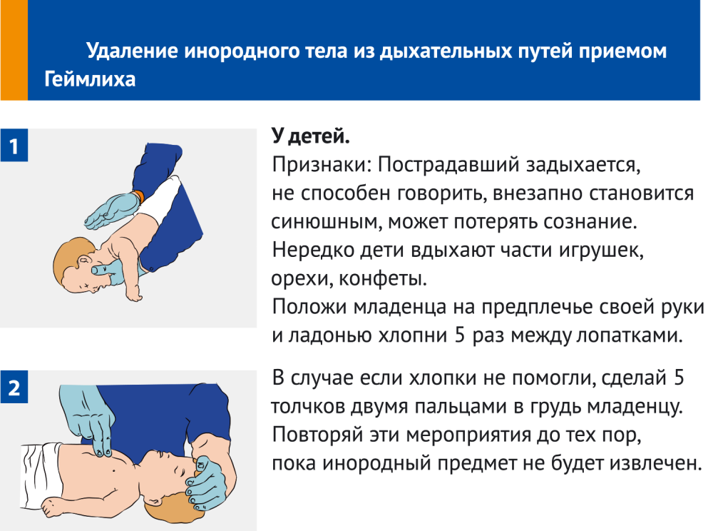 порядок проведения сердечно-легочной реанимации фото