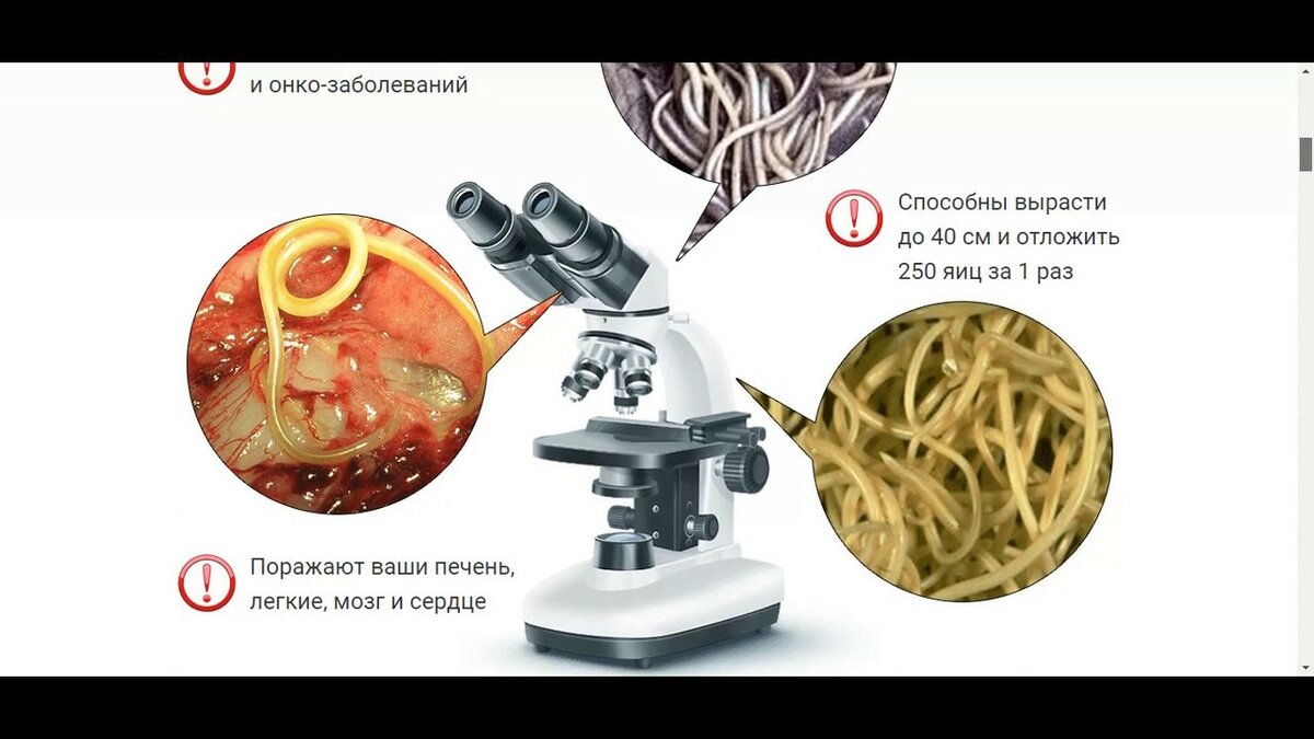 средство от глистов и паразитов фото
