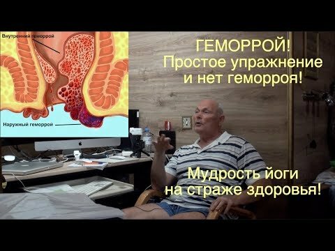 лечение геморроя фото