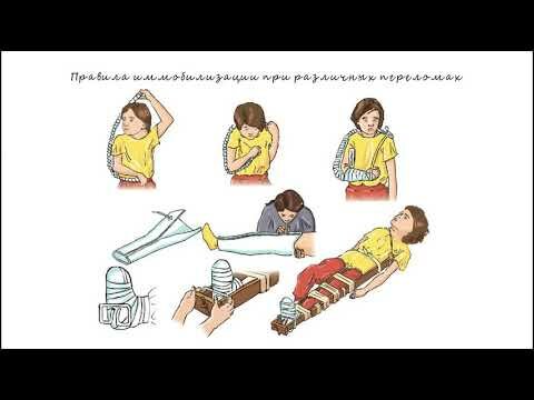 наложение шин при переломах фото