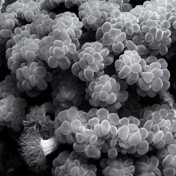 s. aureus золотистый стафилококк фото