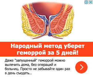 Как быстро снять воспаление геморроя