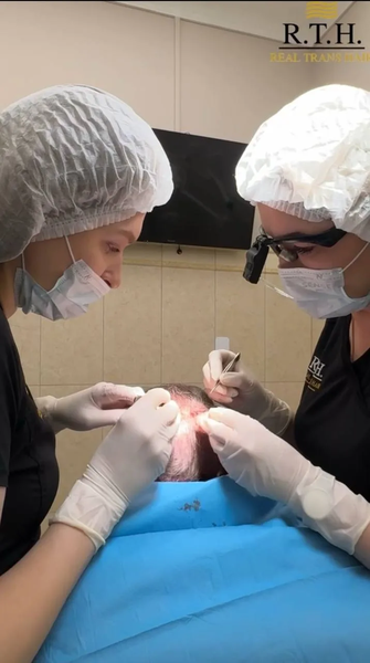 Комфорт во время пересадки волос: насколько это важно?