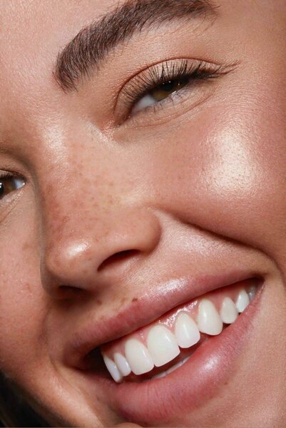 О чем молчат ортодонты: подводные камни красивой улыбки