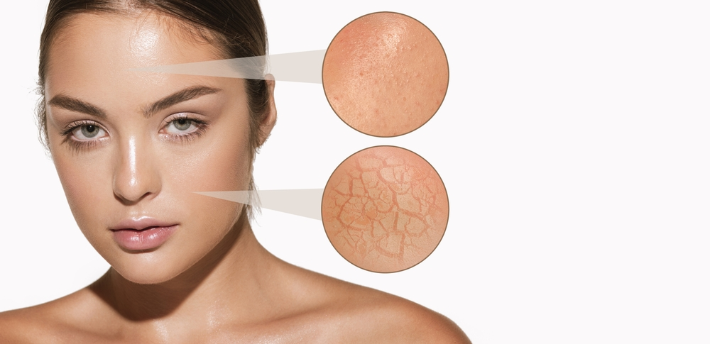 Жирная обезвоженная кожа: тавтология или реальность?