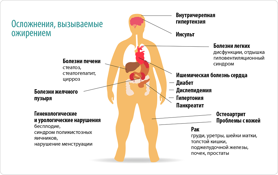 Какие существуют препараты для снижения веса?