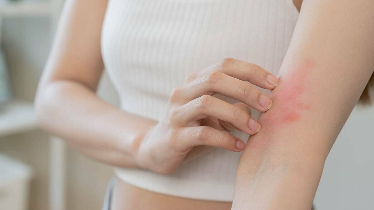 Опрелости при сахарном диабете. Как помочь?