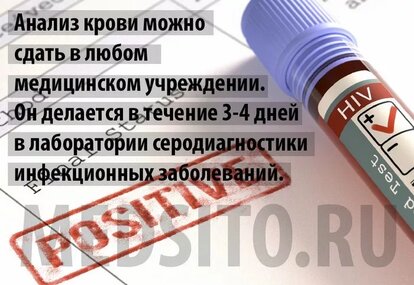 Сколько делается анализ на ВИЧ, подготовка, сроки, нюансы