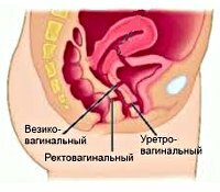 Шейка матки — как выглядит у женщины, где находится, нормы длины