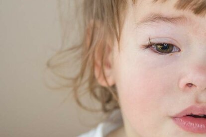 Почему у ребенка может опухнуть щека