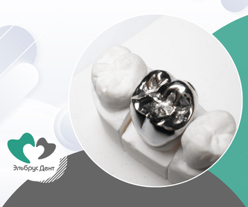 Эльбрус Дент