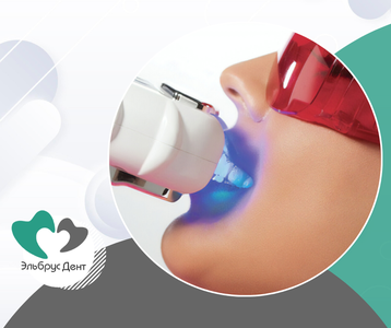 Эльбрус Дент