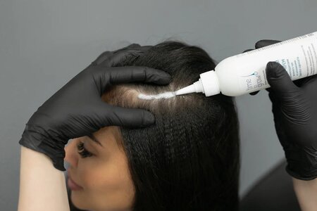 процесс пилинга кожи головы в салоне