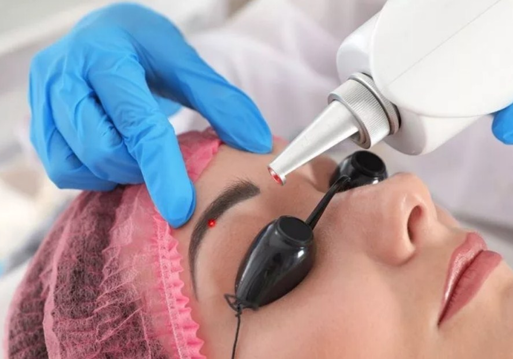  Лазерное удаление татуажа и татуировок