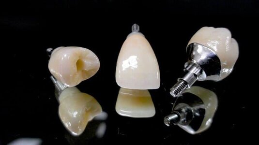 Pin de aniceto lopez en Odontología Cuidado dental, Dental, Estetica dental