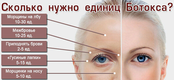 Чем заменить ботокс в домашних условиях