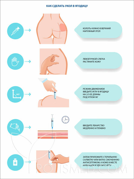 Как правильно делать укол в ягодицу?