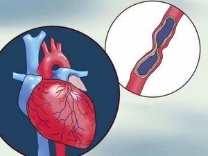 Что делать, если мучает ноющая боль в области сердца?