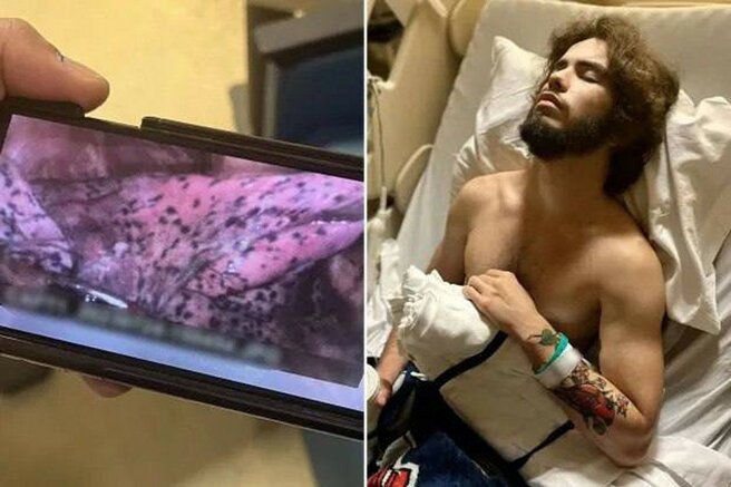 max_g360_c12_r4x3_pd20