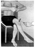 В изображённом на рисунке опыте экспериментатор ударяет пациента
неврологическим молоточком чуть ниже коленной чашечки.