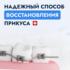 Брекеты