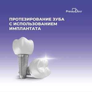 Протезирование зуба с использованием имплантата