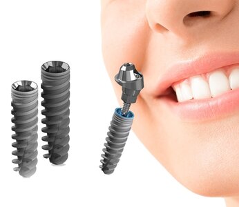 Установка винтового импланта BIOTECH DENTAL KONTACT