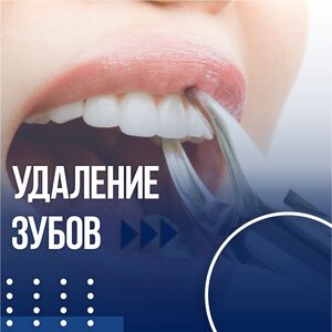 Удаление зубов